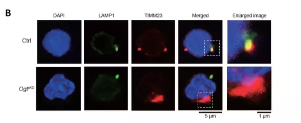 「造血幹細胞の維持に重要な酵素を発見　〜白血病治療などへの応用に期待〜」の画像