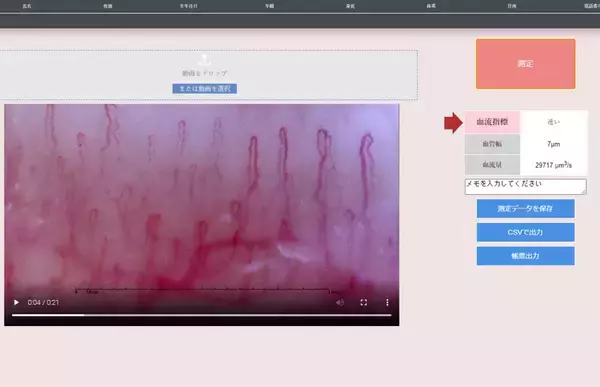 「血流を視覚化＆測定。カルテ機能付きの血流解析ソフト「ViewtyEva ビューティエバ」を正式リリース」の画像