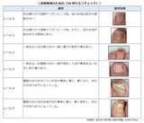 「あなたの爪は大丈夫？1月7日の「爪切りの日」を前に考える足の健康管理　女性にも多い爪水虫、早期発見のための「60秒セルフチェック」」の画像1