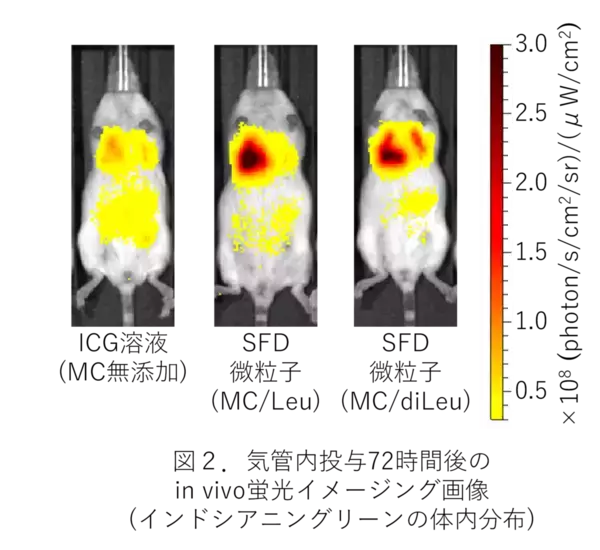 【名城大学】肺に効率的に届けて長く留まる機能性吸入粉末薬を設計