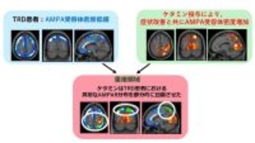【横浜市立大学】ケタミンがうつ症状を改善する仕組みを解明