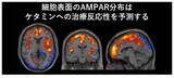 「【横浜市立大学】ケタミンがうつ症状を改善する仕組みを解明」の画像3