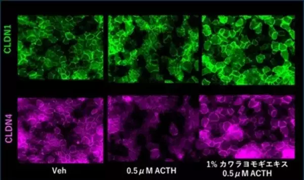「カワラヨモギエキスがストレスによる皮膚バリア機能低下を抑制。「第3回日本化粧品技術者会学術大会」にて最新研究成果を口頭発表」の画像