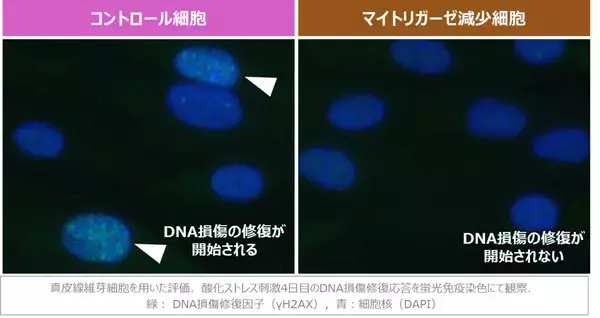 「若返りの鍵「マイトリガーゼ」の新知見～肌が受けたDNAダメージを自ら修復する力は、マイトリガーゼの減少で阻害～」の画像