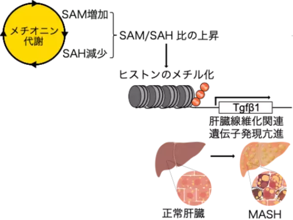 【日本大学】メチオニン代謝の異常を介した新しい肝線維化メカニズムを発見しました～脂肪肝から脂肪肝炎への進行メカニズム解明　新しい治療方法につながる可能性～