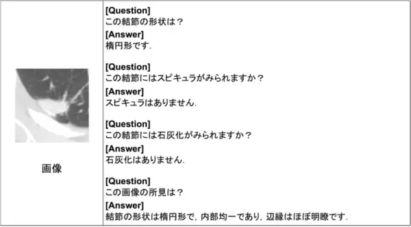 「【名城大学】CT画像×AI対話で所見自動生成　肺がん診断を支援する新技術を開発」の画像
