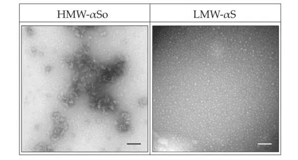 昭和大学などの研究グループがパーキンソン病の原因タンパクであるα-シヌクレインの高分子オリゴマーによる細胞傷害機序の一端を解明