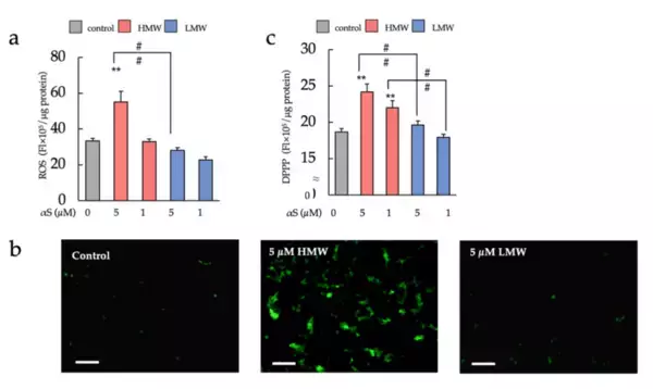 「昭和大学などの研究グループがパーキンソン病の原因タンパクであるα-シヌクレインの高分子オリゴマーによる細胞傷害機序の一端を解明」の画像