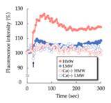 「昭和大学などの研究グループがパーキンソン病の原因タンパクであるα-シヌクレインの高分子オリゴマーによる細胞傷害機序の一端を解明」の画像3