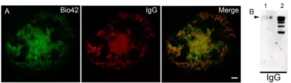 「【東京医科大学】アルツハイマー病のアミロイド斑内における自己抗体の存在とその意義 ～抗体の二面性と治療薬開発におけるピットフォール～」の画像
