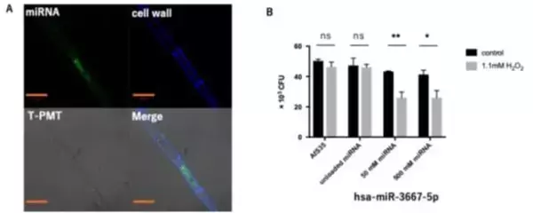 「【東京医科大学】マイクロRNAがもたらす新たな真菌症治療法の可能性 〜真菌症に対する核酸医薬品の開発推進と治療への応用に期待〜」の画像
