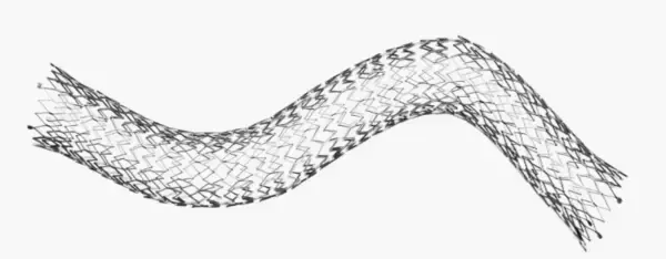 「日本初の下肢静脈専用ステント「VENOVO™ 静脈ステントシステム」販売施設拡大　深部静脈血栓症（DVT）・血栓後症候群（PTS）に、新たな治療の選択肢」の画像