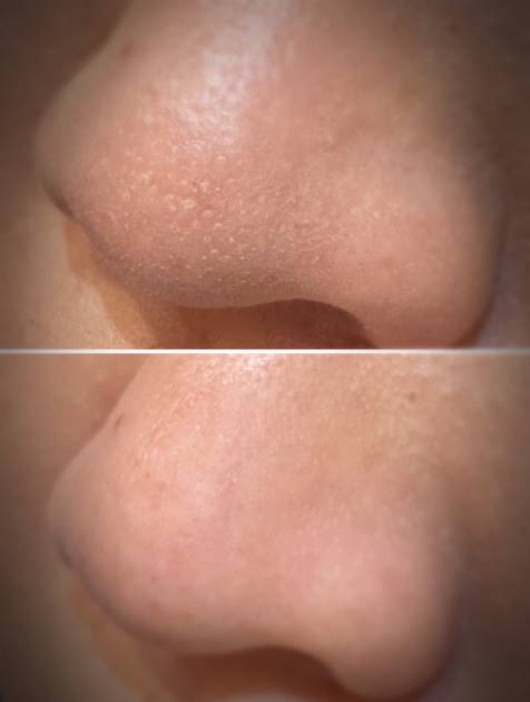 【プロが教える】毛穴落ち小鼻をレスキュー！メイク直しはプチプラで♪