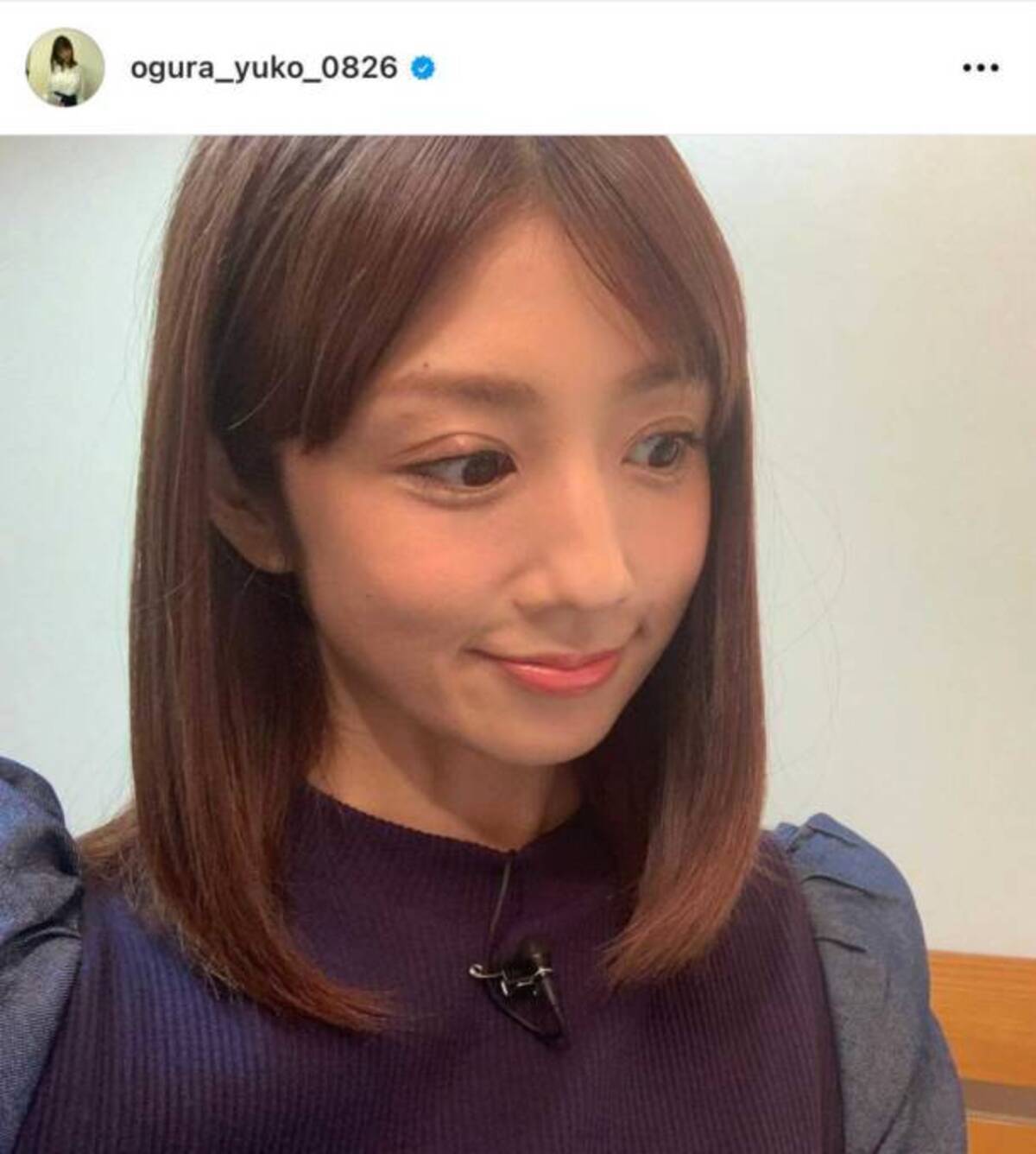 小倉 優子 整形