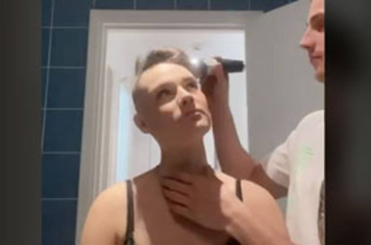 本物の愛 脱毛症の恋人のためバリカンで坊主に そのあと彼氏がとった行動に泣き崩れる 年8月5日 エキサイトニュース