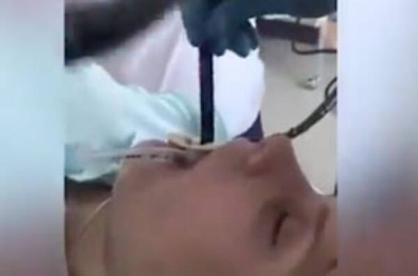 閲覧注意 外で寝ていた女性の口に蛇が 病院でズルリと抜き出され医師が悲鳴をあげる 年9月4日 エキサイトニュース