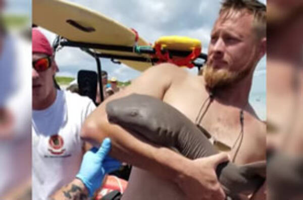 冷静沈着 サメにパクッと腕を噛み付かれたまま平然と救護を待っていた男性が話題に 年9月6日 エキサイトニュース