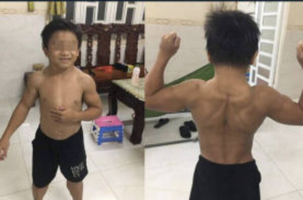 一体なぜ 鍛えてないのに筋肉ムッキムキのベトナム10歳少年 実はこれ遺伝子変異だった 年9月7日 エキサイトニュース