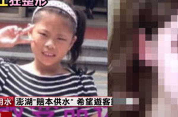 初整形は13歳 中国最年少の整形依存症の少女の顔がやばすぎる 21年1月29日 エキサイトニュース