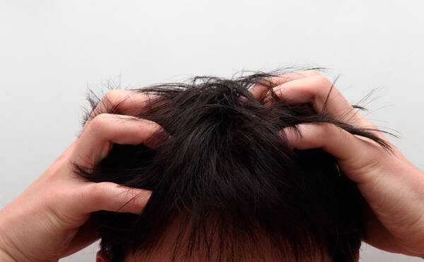 乾燥する季節は要注意 40男のフケ対策 15年11月24日 エキサイトニュース