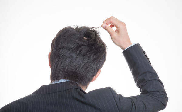 薄毛に悩む男性に朗報 プラセンタ摂取で薄毛改善 16年4月26日 エキサイトニュース