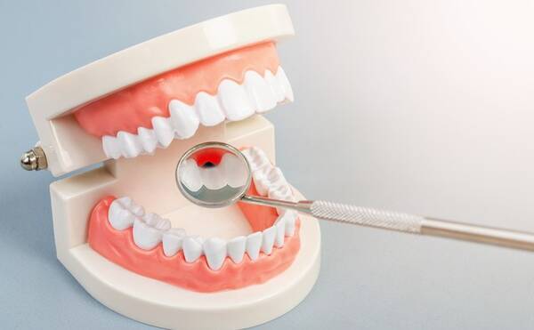 40代の99 が虫歯経験者 痛くない 黒くない歯も要注意 虫歯の発見法 18年7月23日 エキサイトニュース