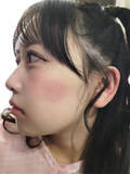 「撮影中にぐっすり！？ FRUITS ZIPPER 松本かれん、頬がしましまになった寝跡ショットが「愛おしすぎる」」の画像1