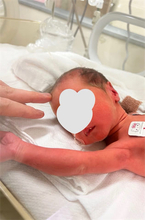 小林礼奈、退院を報告　病院で読者と偶然の出会い「奇跡的な出来事」