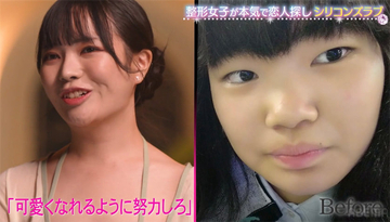 元カレに容姿を指摘され…現役上智大生が、“整形理由”を告白「整形しなかったら生きてなかった」