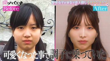 「ブスだから人気がないんだ」24歳元STU48メンバーが“整形”告白「初整形は中学一年生」
