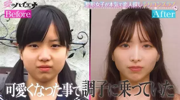 「ブスだから人気がないんだ」24歳元STU48メンバーが“整形”告白「初整形は中学一年生」