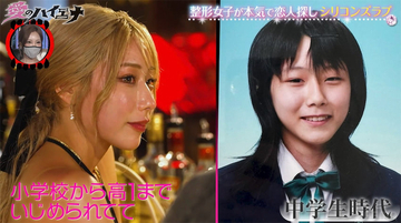 「可愛くないと人権無いと思ってた」整形女子が過去の“いじめ”を告白、29歳で初整形を決意