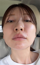 あいのり・桃、顔の片側だけ美顔器で"ポスポス"  衝撃のビフォーアフター披露「すごくない？！」