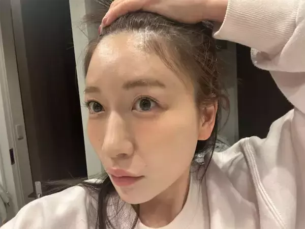 「もしかしてハゲてた…？」あいのり・桃、衝撃のビフォーアフター公開