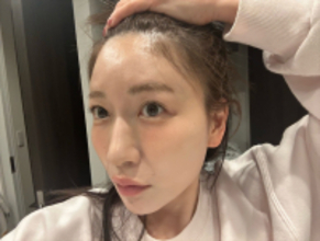 「もしかしてハゲてた…？」あいのり・桃、衝撃のビフォーアフター公開