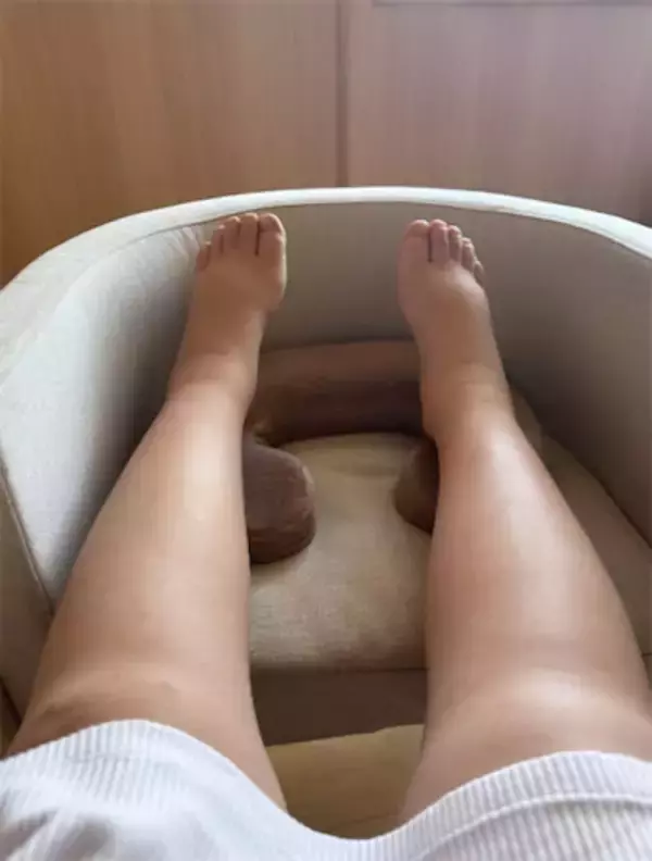 ゆうこす、産後に体がパンパンに浮腫み…「利尿剤で10キロ減」の入院ショットが話題