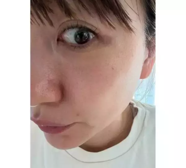 「あいのり･桃「この感覚は初めて…」「すごすぎ韓国の美容医療…」」の画像