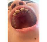 「ココリコ遠藤の妻、次男の矯正を悩む「うちの子、どうしようかなぁ」」の画像1