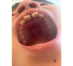 ココリコ遠藤の妻、次男の矯正を悩む「うちの子、どうしようかなぁ」