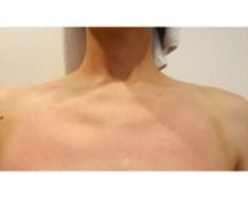 ココリコ遠藤の妻が兄弟ゲンカに疲弊、ストレスで蕁麻疹も…