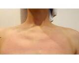 「ココリコ遠藤の妻が兄弟ゲンカに疲弊、ストレスで蕁麻疹も…」の画像2