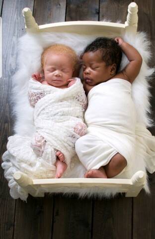 超希少 黒人とアルビノの双子を出産したフォトグラファーの母親が写真に込める思い 年7月13日 エキサイトニュース