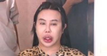 旧友の前で語った壮絶な過去　18歳で整形を始めた理由も明かされる