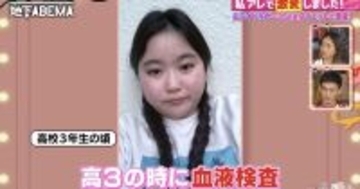 元アイドル女性、高校1年生で体重75kgに　当時の食生活にスタジオ騒然　さらに高校3年生で脂肪肝が発覚
