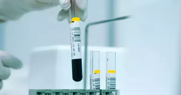 O型はがんになりにくい? 100万人を調査して分かった、血液型と発症リスクの差