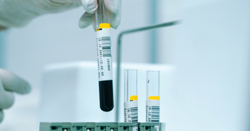 心臓の血管、どこまで傷んでいる?──医師が勧める3段階チェック法