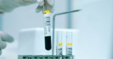 心臓の血管、どこまで傷んでいる?──医師が勧める3段階チェック法