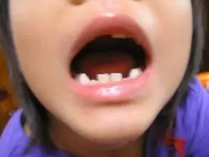 “死ぬほど痛い歯医者”はなぜ減ったのか