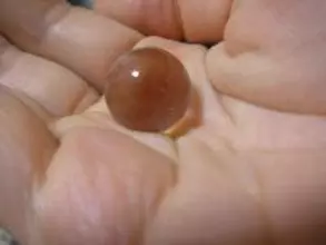 のどから出てくる「臭玉」って知ってる？