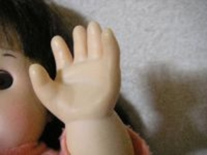 「しもやけおてて」は絶滅したのか